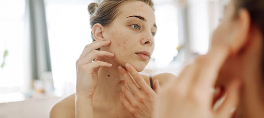INFLAMMATION AND ITS EFFECTS ON THE SKIN